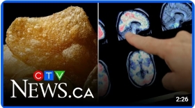 Troubling new link between brain damage and ultra-processed foods found in decade-long study